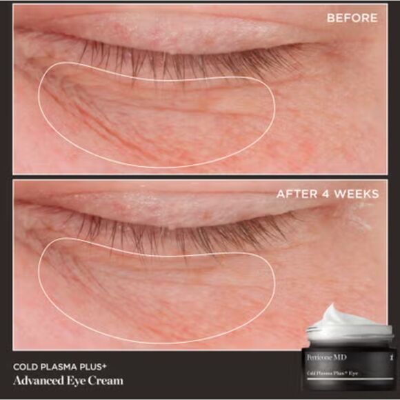 NIB Perricone MD Cold Plasma+ Advanced Eye Cream - Picture 2 of 10